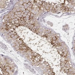 Invitrogen SLC7A4 Polyclonal Antibody 100 &mu;L; Unconjugated:Antibodies,