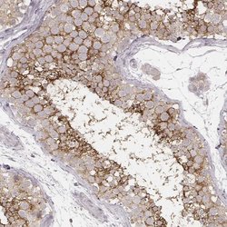Invitrogen SLC7A4 Polyclonal Antibody 100 &mu;L; Unconjugated:Antibodies,
