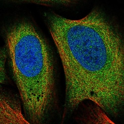 Invitrogen PCID1 Polyclonal Antibody 100 &mu;L; Unconjugated:Antibodies,