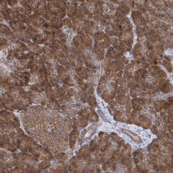 Invitrogen PCID1 Polyclonal Antibody 100 &mu;L; Unconjugated:Antibodies,