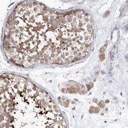 Invitrogen PCID1 Polyclonal Antibody 100 &mu;L; Unconjugated:Antibodies,