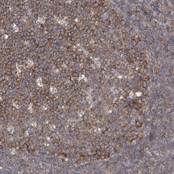 Invitrogen PCID1 Polyclonal Antibody 100 &mu;L; Unconjugated:Antibodies,
