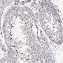 Invitrogen Kir6.1 (KCNJ8) Polyclonal Antibody 100 &mu;L | Buy Online | Invitrogen&trade; | Fisher Scientific