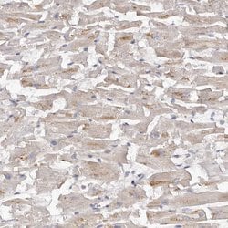 Invitrogen Kir6.1 (KCNJ8) Polyclonal Antibody 100 &mu;L | Buy Online | Invitrogen&trade; | Fisher Scientific