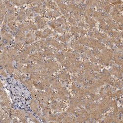 Invitrogen Kir6.1 (KCNJ8) Polyclonal Antibody 100 &mu;L | Buy Online | Invitrogen&trade; | Fisher Scientific