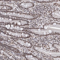 Invitrogen PRUNE2 Polyclonal Antibody 100 &mu;L; Unconjugated:Antibodies,