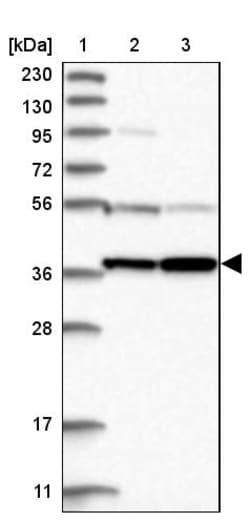 Invitrogen PRUNE2 Polyclonal Antibody 100 &mu;L; Unconjugated:Antibodies,