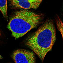 Invitrogen ZC3H15 Polyclonal Antibody 100 &mu;L; Unconjugated:Antibodies,