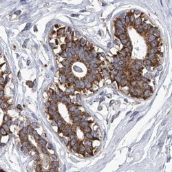 Invitrogen ZC3H15 Polyclonal Antibody 100 &mu;L; Unconjugated:Antibodies,