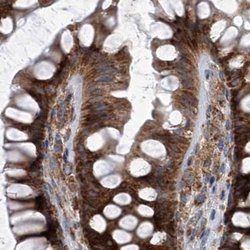 Invitrogen ZC3H15 Polyclonal Antibody 100 &mu;L; Unconjugated:Antibodies,