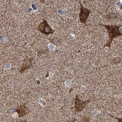 Invitrogen ZC3H15 Polyclonal Antibody 100 &mu;L; Unconjugated:Antibodies,