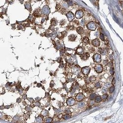 Invitrogen ZC3H15 Polyclonal Antibody 100 &mu;L; Unconjugated:Antibodies,