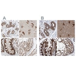 Invitrogen ZC3H15 Polyclonal Antibody 100 &mu;L; Unconjugated:Antibodies,