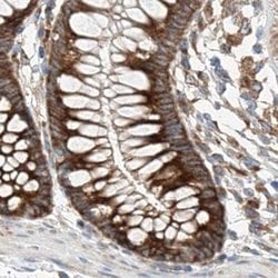 Invitrogen ZC3H15 Polyclonal Antibody 100 &mu;L; Unconjugated:Antibodies,
