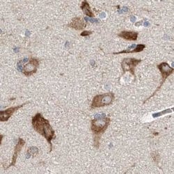 Invitrogen ZC3H15 Polyclonal Antibody 100 &mu;L; Unconjugated:Antibodies,
