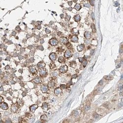 Invitrogen ZC3H15 Polyclonal Antibody 100 &mu;L; Unconjugated:Antibodies,
