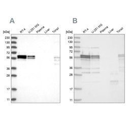Invitrogen ZC3H15 Polyclonal Antibody 100 &mu;L; Unconjugated:Antibodies,