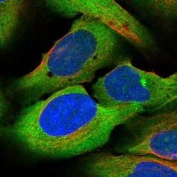 ZC3H15 Polyclonal Antibody:Antibodies, Polyclonal