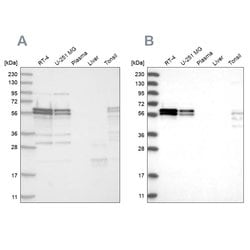 ZC3H15 Polyclonal Antibody:Antibodies, Polyclonal