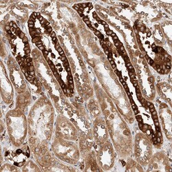 Invitrogen DHRS7 Polyclonal Antibody 100 &mu;L; Unconjugated:Antibodies,