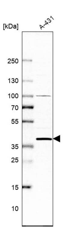 Invitrogen DHRS7 Polyclonal Antibody 100 &mu;L; Unconjugated:Antibodies,