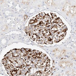 Invitrogen CDCP2 Polyclonal Antibody 100 &mu;L; Unconjugated:Antibodies,