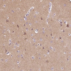 Invitrogen DNAJC6 Polyclonal Antibody 100 &mu;L; Unconjugated:Antibodies,