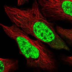 Invitrogen SART1 Polyclonal Antibody 100 &mu;L; Unconjugated:Antibodies,