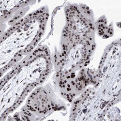 Invitrogen SART1 Polyclonal Antibody 100 &mu;L; Unconjugated:Antibodies,