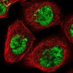 Invitrogen SART1 Polyclonal Antibody 100 &mu;L; Unconjugated:Antibodies,