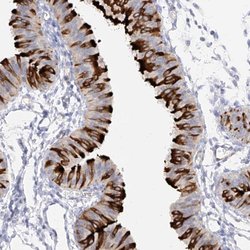 Invitrogen RSPH4A Polyclonal Antibody 100 μL; Unconjugated:Antibodies,