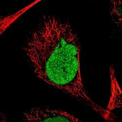 Invitrogen RSPH4A Polyclonal Antibody 100 μL; Unconjugated:Antibodies,