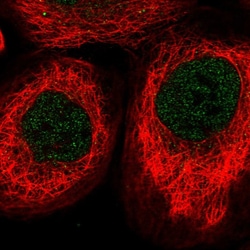 RSPH4A Polyclonal Antibody:Antibodies, Polyclonal