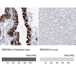 RSPH4A Polyclonal Antibody:Antibodies, Polyclonal