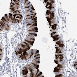 RSPH4A Polyclonal Antibody:Antibodies, Polyclonal