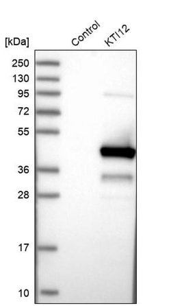 KTI12 Polyclonal Antibody 100 &mu;L | Buy Online | Thermo Scientific | Fisher Scientific