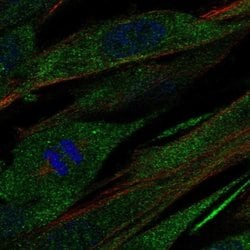 Invitrogen COL21A1 Polyclonal Antibody 100 &mu;L; Unconjugated:Antibodies,
