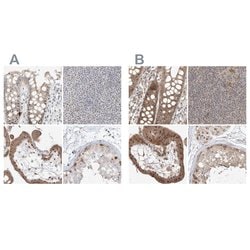 Invitrogen BYSL Polyclonal Antibody 100 &mu;L; Unconjugated:Antibodies,