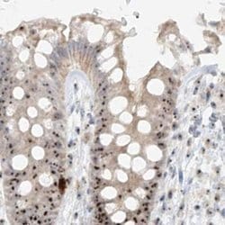 Invitrogen BYSL Polyclonal Antibody 100 &mu;L; Unconjugated:Antibodies,
