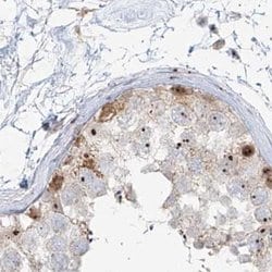 Invitrogen BYSL Polyclonal Antibody 100 &mu;L; Unconjugated:Antibodies,