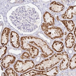Invitrogen PKHD1 Polyclonal Antibody 100 &mu;L; Unconjugated:Antibodies,