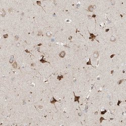 TSSC1 Polyclonal Antibody, Invitrogen™