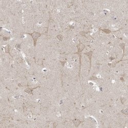 TSSC1 Polyclonal Antibody, Invitrogen™