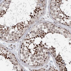 Invitrogen SDE2 Polyclonal Antibody 100 &mu;L; Unconjugated:Antibodies,