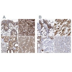 COQ3 Polyclonal Antibody:Antibodies, Polyclonal