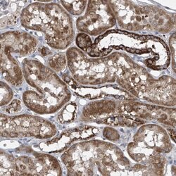 COQ3 Polyclonal Antibody:Antibodies, Polyclonal