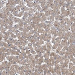 COQ3 Polyclonal Antibody:Antibodies, Polyclonal