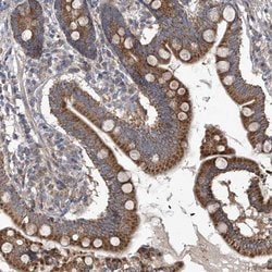 COQ3 Polyclonal Antibody:Antibodies, Polyclonal