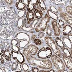 COQ3 Polyclonal Antibody:Antibodies, Polyclonal