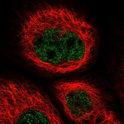 ZNF529 Polyclonal Antibody:Antibodies, Polyclonal